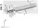 Fig. 06 - Micro-invasive surgical device and methods of use