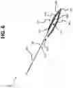 Fig. 07 - Micro-invasive surgical device and methods of use
