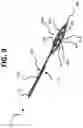 Fig. 10 - Micro-invasive surgical device and methods of use