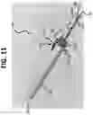 Fig. 12 - Micro-invasive surgical device and methods of use