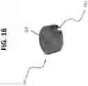Fig. 17 - Micro-invasive surgical device and methods of use