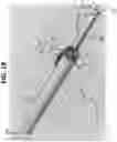 Fig. 20 - Micro-invasive surgical device and methods of use