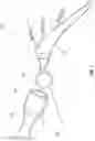 Fig. 08 - Bone preparation apparatus and method