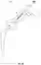 Fig. 11 - Bone preparation apparatus and method