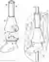 Fig. 01 - Access device with anchoring body and modular inserts and support structure for supporting accessories used in minimally invasive surgical procedures