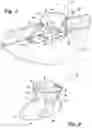 Fig. 02 - Access device with anchoring body and modular inserts and support structure for supporting accessories used in minimally invasive surgical procedures