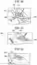 Fig. 19 - Skin foundation access portal