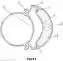 Fig. 03 - Visualized surgical assembly and corresponding endoscope thereof