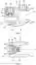 Fig. 05 - Band clamp implants