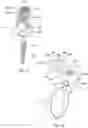 Fig. 10 - Band clamp implants