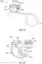 Fig. 24 - Band clamp implants