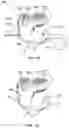 Fig. 27 - Band clamp implants