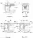 Fig. 29 - Band clamp implants