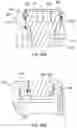 Fig. 31 - Band clamp implants