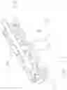 Fig. 05 - Matrix implant