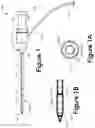 Fig. 02 - Bone expansion systems and methods