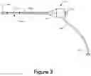 Fig. 04 - Bone expansion systems and methods