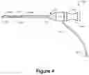Fig. 05 - Bone expansion systems and methods