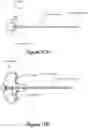 Fig. 11 - Bone expansion systems and methods