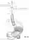 Fig. 19 - MEDICAL SYSTEM AND METHOD OF USE