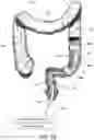 Fig. 25 - MEDICAL SYSTEM AND METHOD OF USE