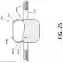 Fig. 34 - MEDICAL SYSTEM AND METHOD OF USE