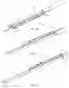 Fig. 15 - TELESCOPING SMOKE EVACUATION DEVICE FOR USE WITH HANDHELD SURGICAL INSTRUMENT