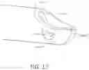 Fig. 15 - Arthroscopic devices and methods