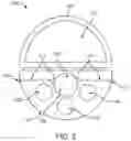 Fig. 03 - MATERIAL REMOVAL FROM SURGICAL SITE