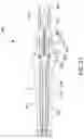 Fig. 21 - Surgical clamp