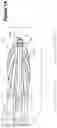 Fig. 02 - DETERMINING SHAPE OF EXPANDABLE DISTAL MEMBER OF A CATHETER
