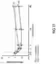 Fig. 40 - METHODS AND SYSTEMS FOR TREATING DIABETES AND RELATED DISEASES AND DISORDERS
