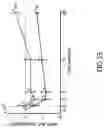 Fig. 44 - METHODS AND SYSTEMS FOR TREATING DIABETES AND RELATED DISEASES AND DISORDERS