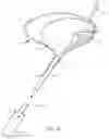 Fig. 11 - Apparatus and methods to modulate bladder function