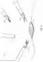 Fig. 04 - SYSTEMS AND METHODS FOR FACILITATING INSERTION OF A SURGICAL INSTRUMENT INTO A SURGICAL SPACE