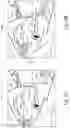 Fig. 07 - SYSTEMS AND METHODS FOR FACILITATING INSERTION OF A SURGICAL INSTRUMENT INTO A SURGICAL SPACE