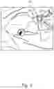 Fig. 09 - SYSTEMS AND METHODS FOR FACILITATING INSERTION OF A SURGICAL INSTRUMENT INTO A SURGICAL SPACE