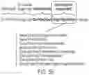 Fig. 16 - Algorithm-based optimization, tool and selectable simulation data for total hip arthroplasty