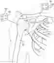 Fig. 01 - Robotic system for shoulder arthroplasty using stemless implant components