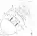 Fig. 06 - Robotic system for shoulder arthroplasty using stemless implant components