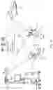 Fig. 36 - Augmented reality in arthroplasty surgery