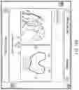 Fig. 42 - Augmented reality in arthroplasty surgery