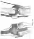 Fig. 43 - Augmented reality in arthroplasty surgery