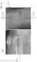 Fig. 59 - Augmented reality in arthroplasty surgery