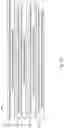 Fig. 14 - TECHNIQUE FOR DETERMINING A RADIUS OF A SPHERICALLY SHAPED SURFACE PORTION OF AN INSTRUMENT TIP