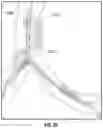 Fig. 29 - WEIGHT-BASED REGISTRATION OF LOCATION SENSORS