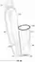 Fig. 09 - Robotic-assisted navigation and control for airway management procedures, assemblies and systems