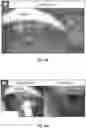 Fig. 20 - Robotic-assisted navigation and control for airway management procedures, assemblies and systems