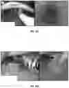 Fig. 21 - Robotic-assisted navigation and control for airway management procedures, assemblies and systems