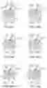Fig. 19 - ELECTROMECHANICAL SURGICAL SYSTEM INCLUDING LINEARLY DRIVEN INSTRUMENT ROLL